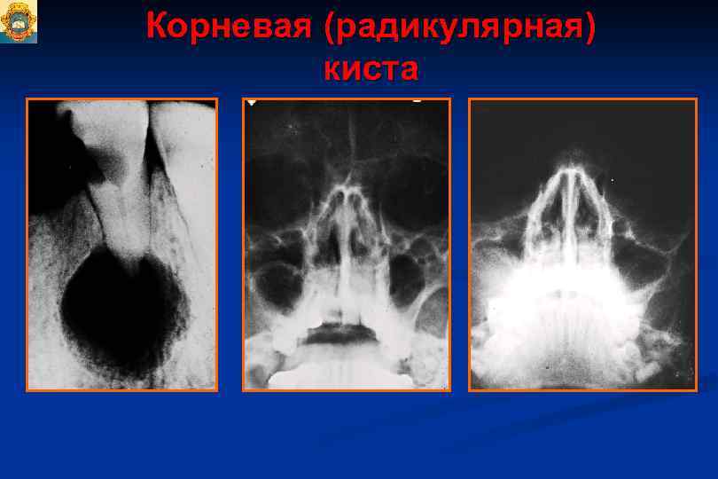 Презентация одонтогенные опухоли