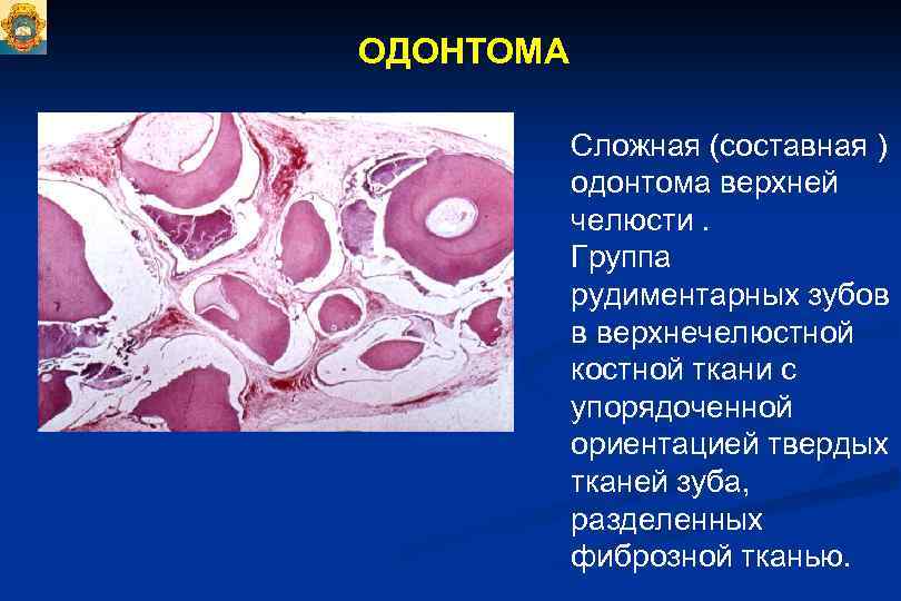 Презентация одонтогенные опухоли