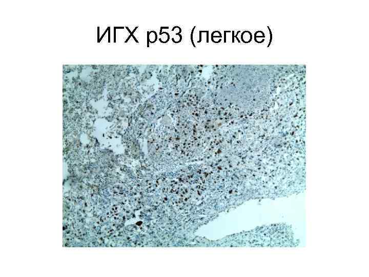 ИГХ р53 (легкое) 