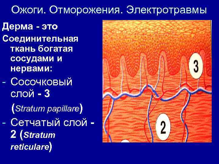 Ожоги. Отморожения. Электротравмы Дерма - это Соединительная ткань богатая сосудами и нервами: - Сосочковый