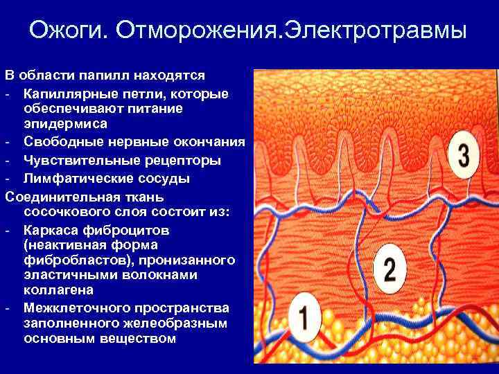 Ожоги. Отморожения. Электротравмы В области папилл находятся - Капиллярные петли, которые обеспечивают питание эпидермиса