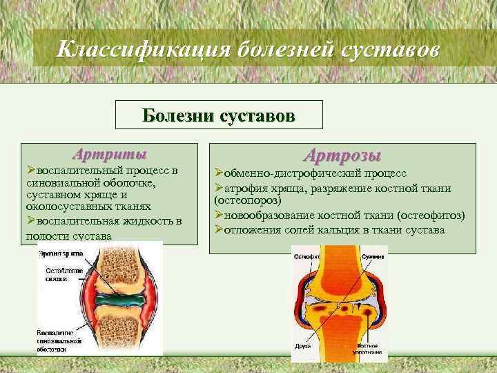 Стол при болезни суставов