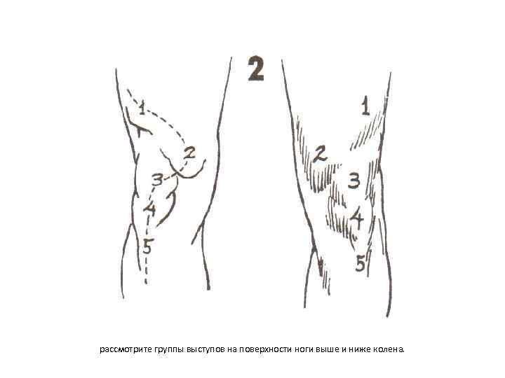 рассмотрите группы выступов на поверхности ноги выше и ниже колена. 