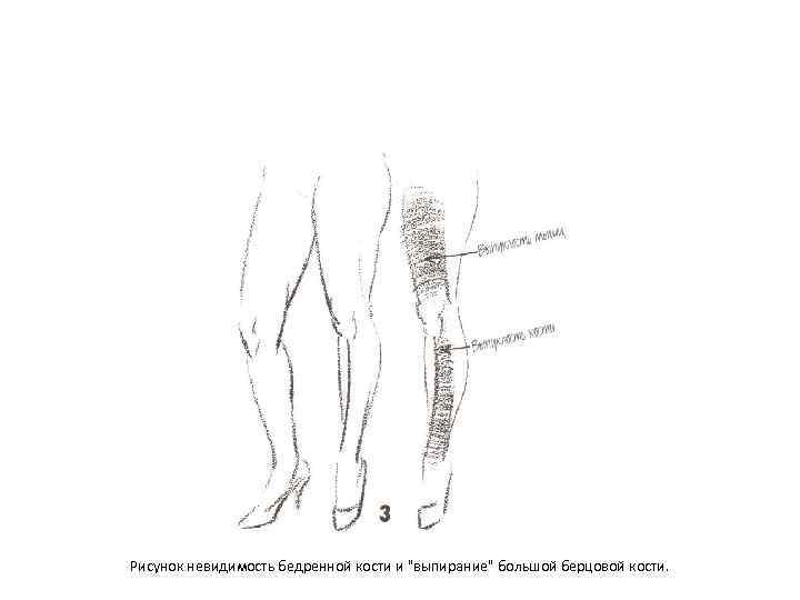 Рисунок невидимость бедренной кости и 