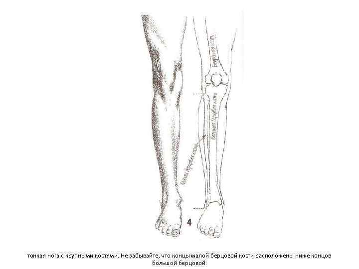 тонкая нога с крупными костями. Не забывайте, что концы малой берцовой кости расположены ниже