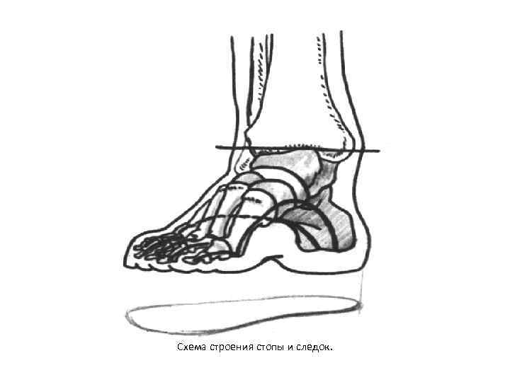 Схема строения стопы и следок. 