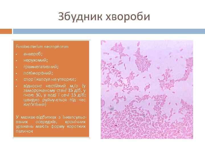 Збудник хвороби Fusobacterium necrophorum • • • анаероб; нерухомий; грамнегативний; поліморфний; спор і капсул