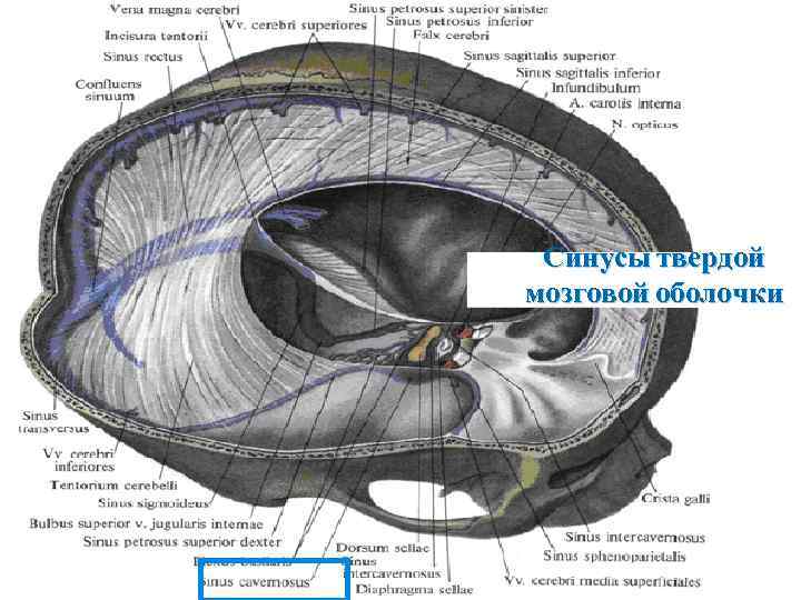 Синус оболочки мозга. Синусы твердой оболочки головного мозга. Синусы твердой мозговой оболочки гистология. Синусы твердой мозговой оболочки (Sinus durae matris encephali) по в.в. Квашуку (2002):. Хирургическая анатомия синусов твердой мозговой оболочки.