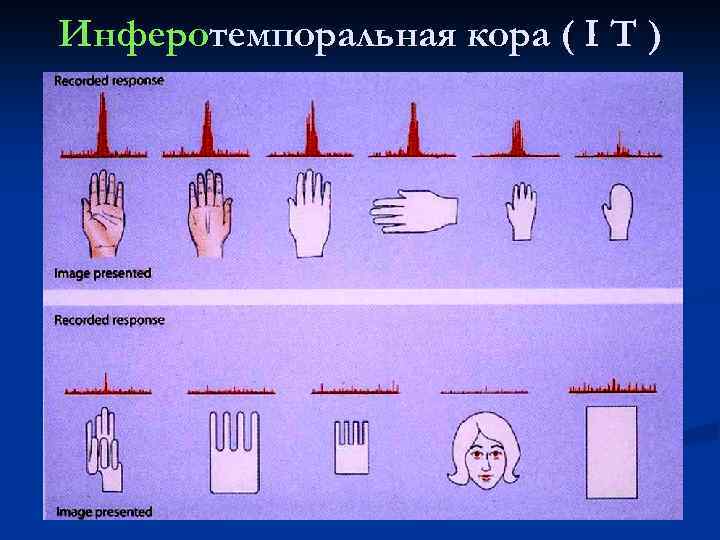 Инферотемпоральная кора ( I T ) 