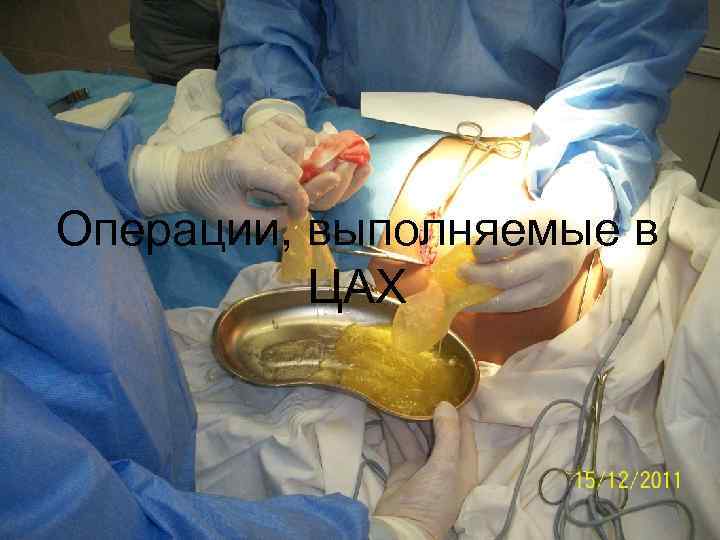 Операции, выполняемые в ЦАХ 