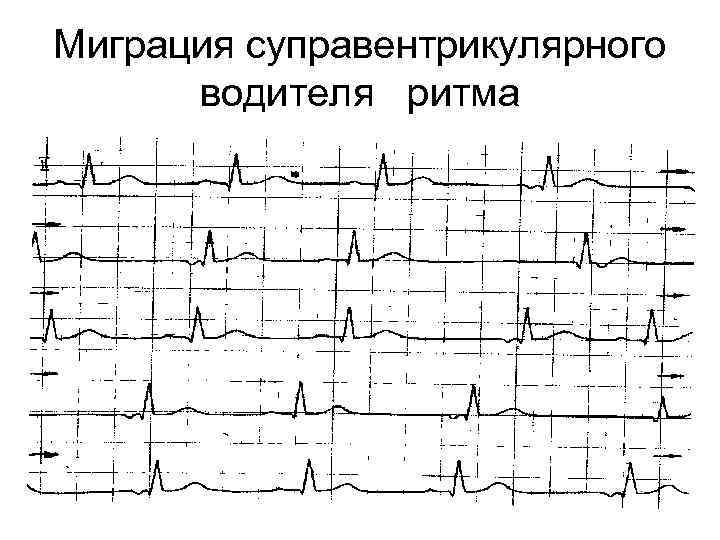 Миграция водителя ритма код