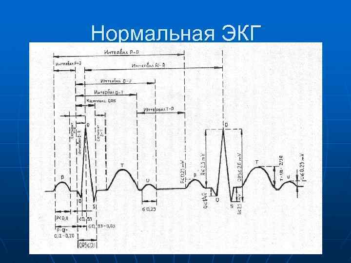 Нормальная ЭКГ 