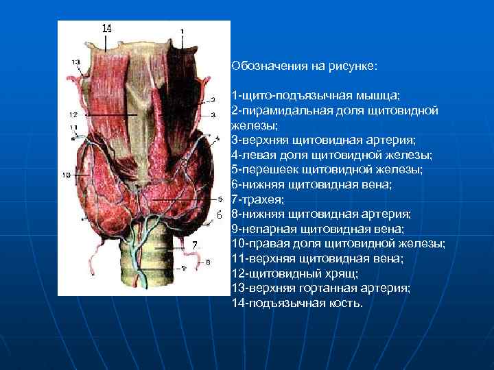 Обозначения на рисунке: 1 -щито-подъязычная мышца; 2 -пирамидальная доля щитовидной железы; 3 -верхняя щитовидная