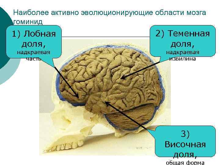 Наиболее активно эволюционирующие области мозга гоминид 1) Лобная доля, надкраевая часть 2) Теменная доля,
