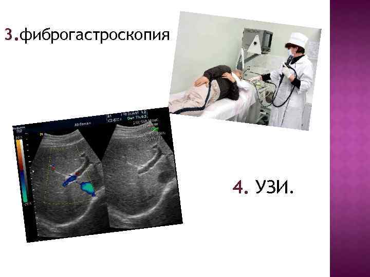 3. фиброгастроскопия 4. УЗИ. 