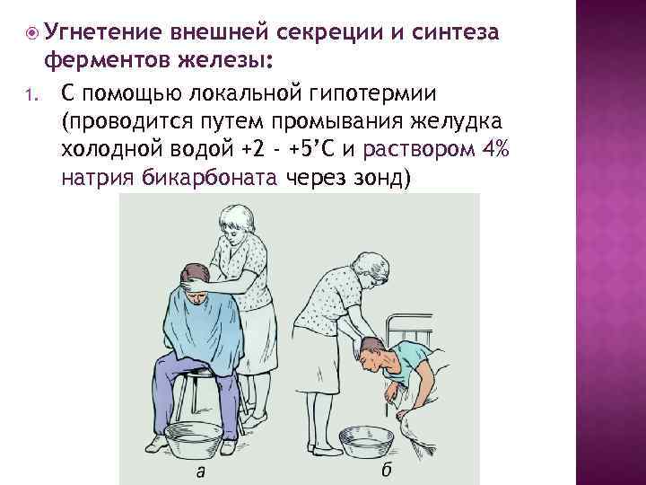  Угнетение внешней секреции и синтеза ферментов железы: 1. С помощью локальной гипотермии (проводится
