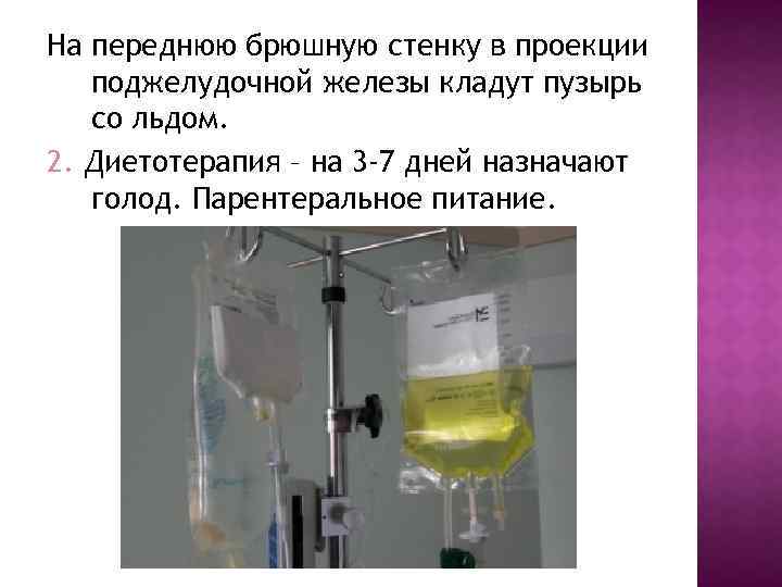 На переднюю брюшную стенку в проекции поджелудочной железы кладут пузырь со льдом. 2. Диетотерапия
