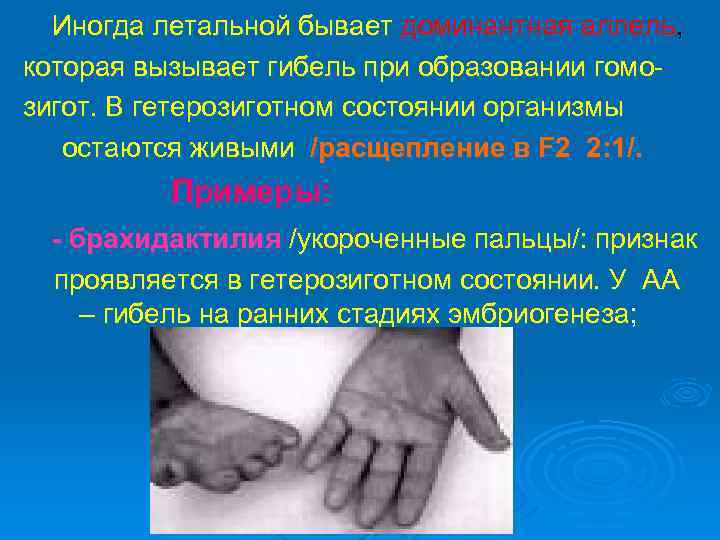 Иногда летальной бывает доминантная аллель, которая вызывает гибель при образовании гомозигот. В гетерозиготном состоянии