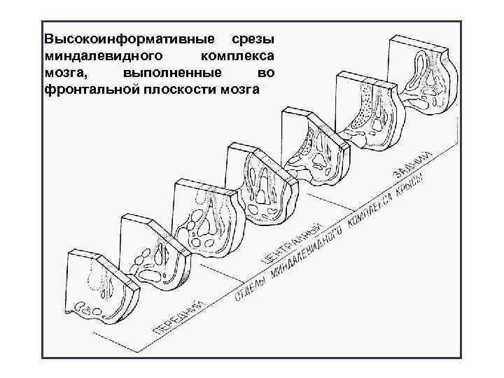 Высокоинформативные срезы миндалевидного комплекса мозга, выполненные во фронтальной плоскости мозга 