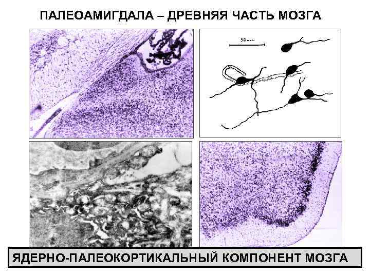 ПАЛЕОАМИГДАЛА – ДРЕВНЯЯ ЧАСТЬ МОЗГА ЯДЕРНО-ПАЛЕОКОРТИКАЛЬНЫЙ КОМПОНЕНТ МОЗГА 