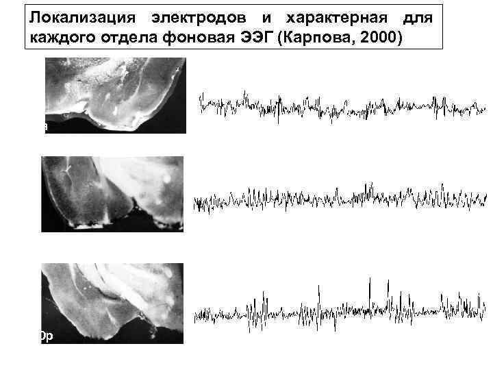 Локализация электродов и характерная для каждого отдела фоновая ЭЭГ (Карпова, 2000) COa PAC COp