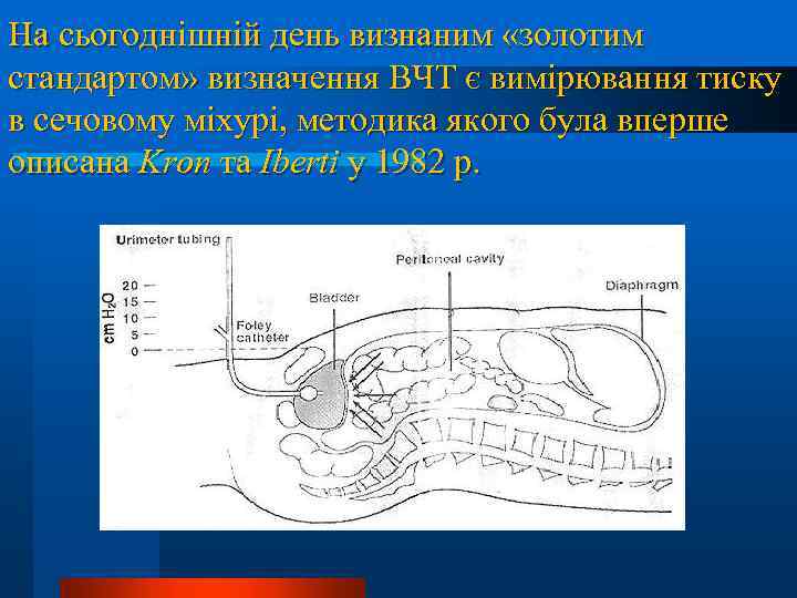 На сьогоднішній день визнаним «золотим стандартом» визначення ВЧТ є вимірювання тиску в сечовому міхурі,