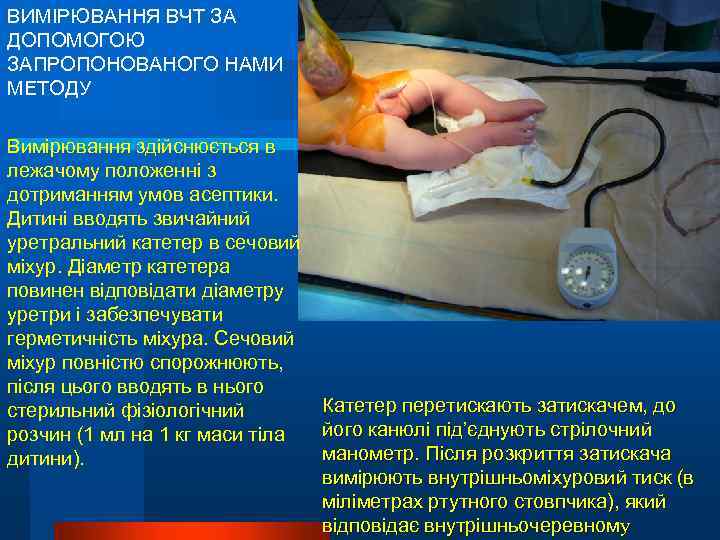 ВИМІРЮВАННЯ ВЧТ ЗА ДОПОМОГОЮ ЗАПРОПОНОВАНОГО НАМИ МЕТОДУ Вимірювання здійснюється в лежачому положенні з дотриманням