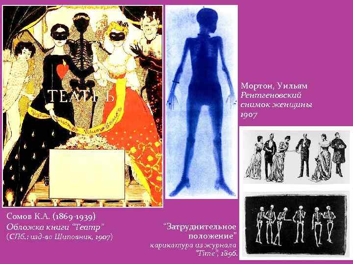Мортон, Уильям Рентгеновский снимок женщины 1907 Сомов К. А. (1869 -1939) Обложка книги “Театр”