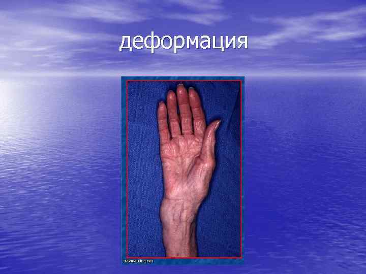 деформация 