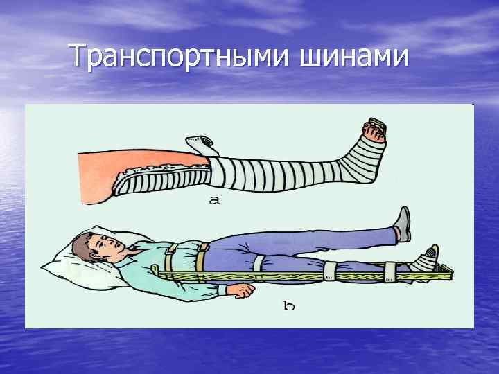 Транспортными шинами 