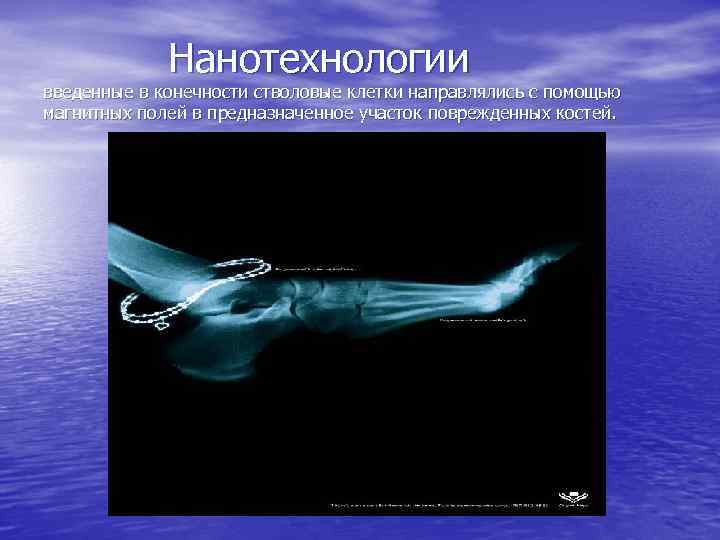 Нанотехнологии введенные в конечности стволовые клетки направлялись с помощью магнитных полей в предназначенное участок