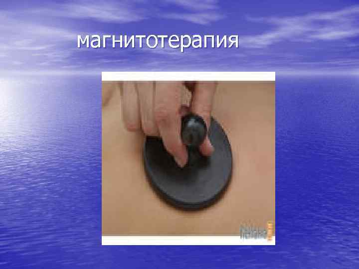 магнитотерапия 