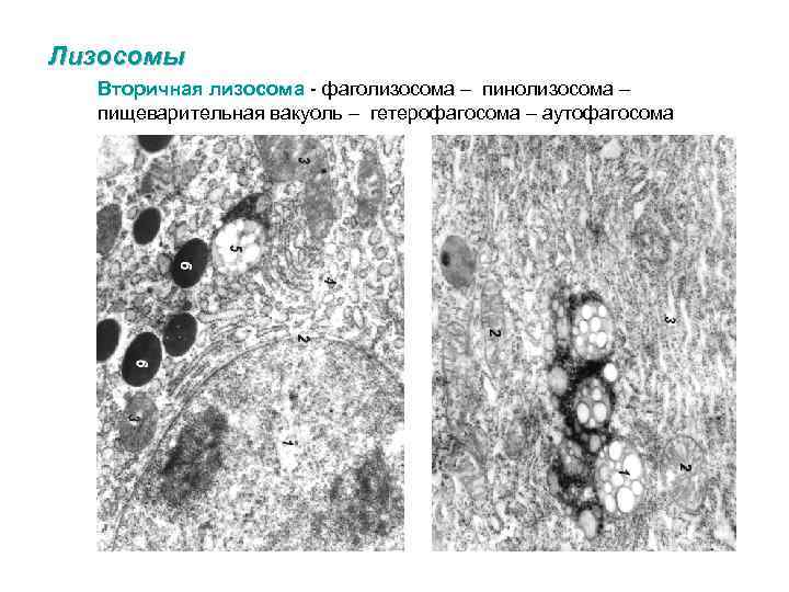 Лизосомы Вторичная лизосома - фаголизосома – пинолизосома – пищеварительная вакуоль – гетерофагосома – аутофагосома