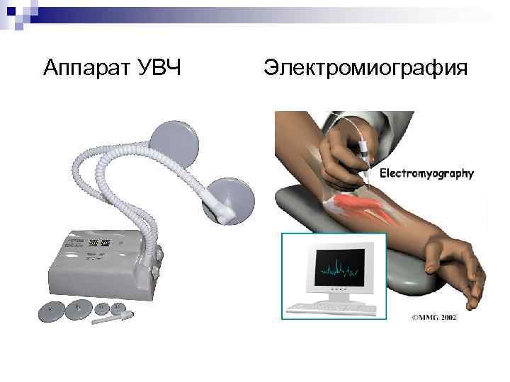  Аппарат УВЧ Электромиография 