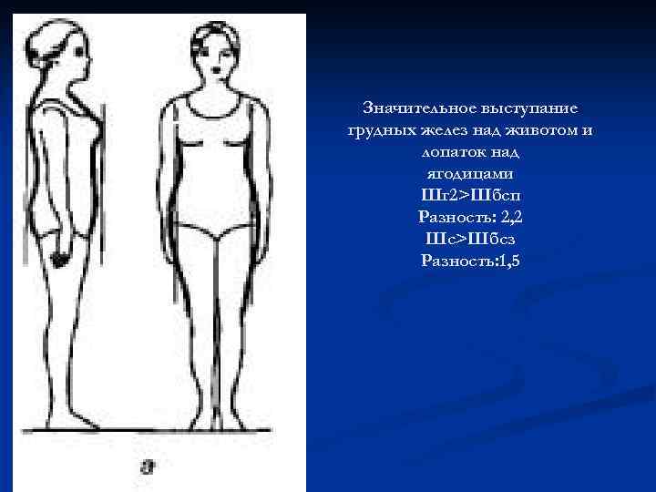 Значительное выступание грудных желез над животом и лопаток над ягодицами Шг 2>Шбсп Разность: 2,