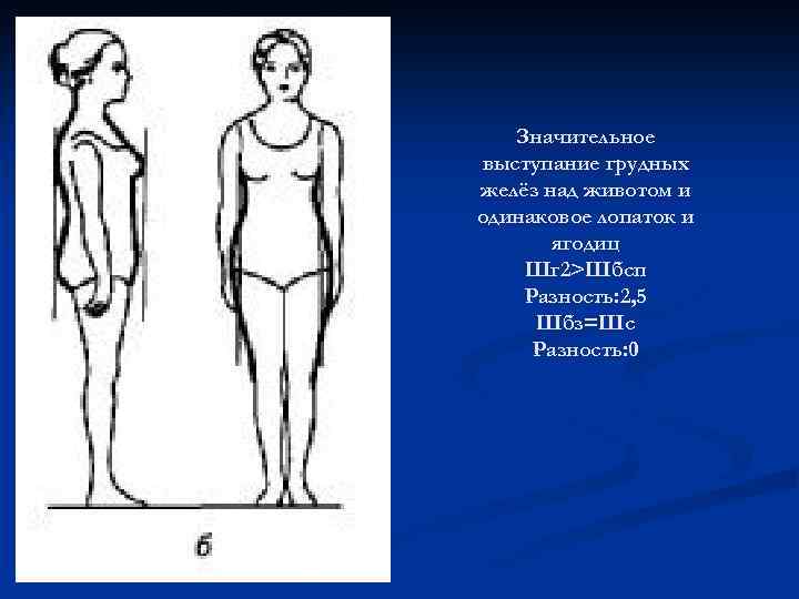 Значительное выступание грудных желёз над животом и одинаковое лопаток и ягодиц Шг 2>Шбсп Разность: