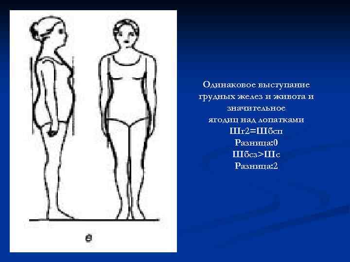 Одинаковое выступание грудных желез и живота и значительное ягодиц над лопатками Шг 2=Шбсп Разница: