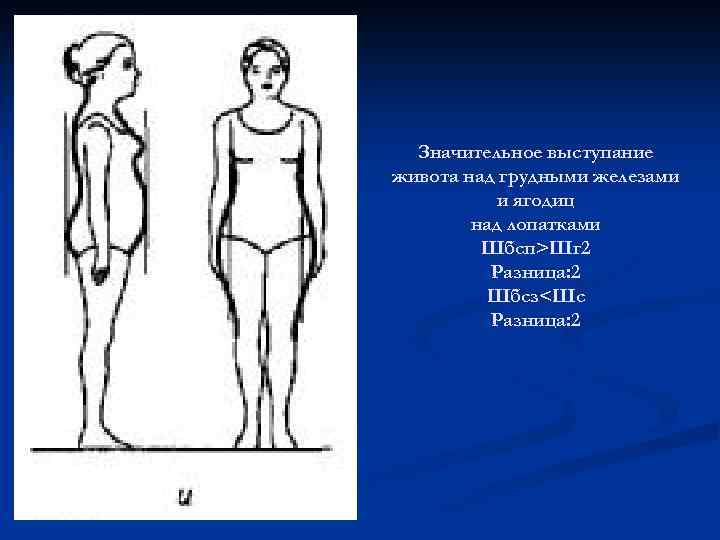 Значительное выступание живота над грудными железами и ягодиц над лопатками Шбсп>Шг 2 Разница: 2