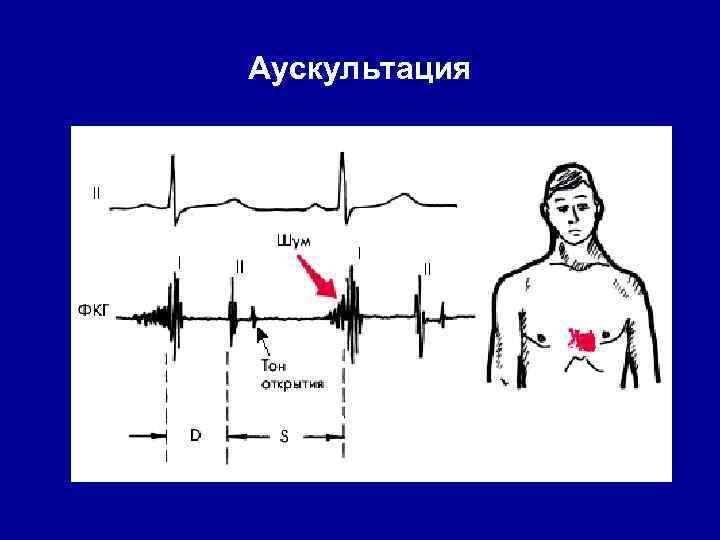 Аускультация 
