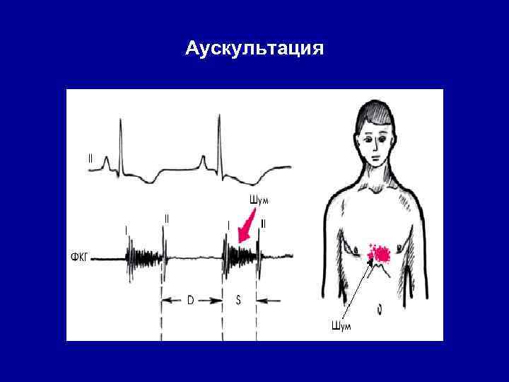 Аускультация 
