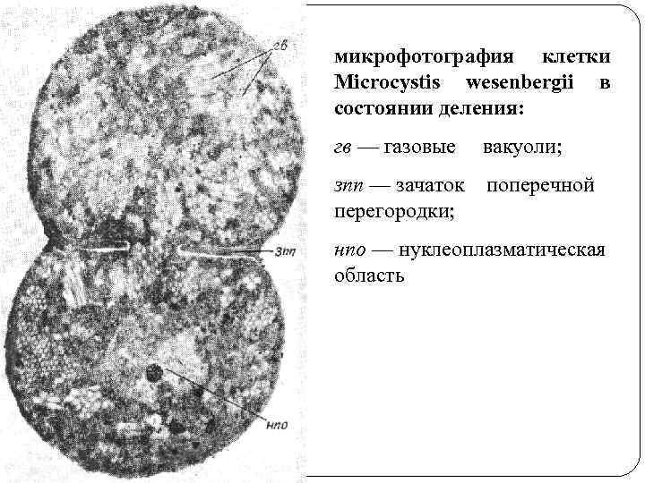 микрофотография клетки Microcystis wesenbergii в состоянии деления: гв — газовые вакуоли; зпп — зачаток