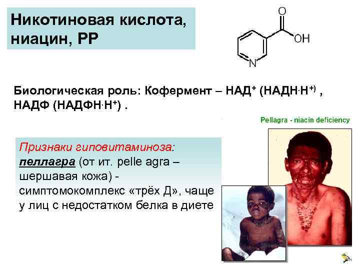 Никотиновая кислота, ниацин, РР Биологическая роль: Кофермент – НАД+ (НАДН. Н+) , НАДФ (НАДФН.
