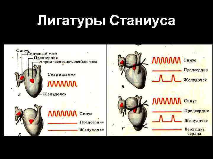 Схема наложения лигатур