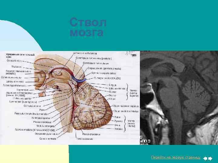 Ствол мозга Перейти на первую страницу 
