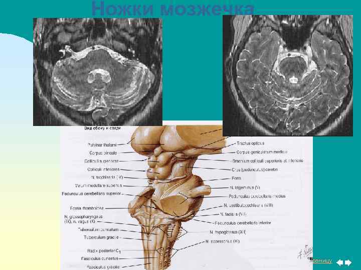 Ножки мозжечка Перейти на первую страницу 