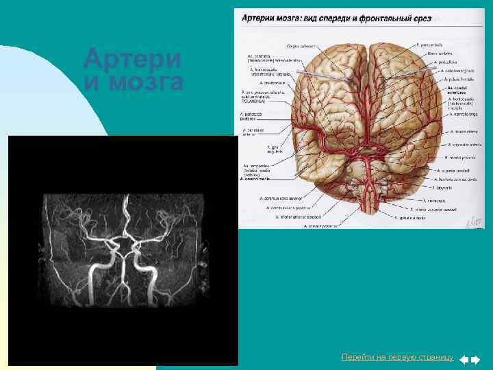 Артери и мозга Перейти на первую страницу 