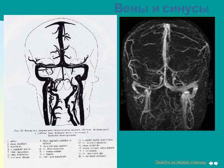 Вены и синусы Перейти на первую страницу 