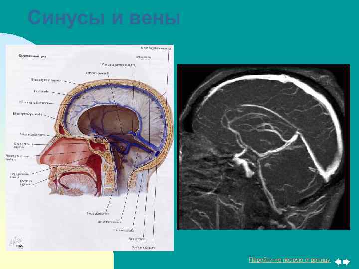 Синусы и вены Перейти на первую страницу 