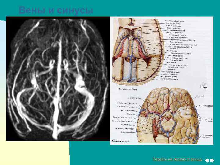 Вены и синусы Перейти на первую страницу 