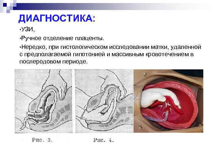 Отделение последа у коровы схема